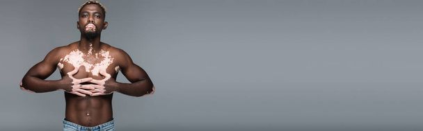 без сорочки афроамериканський чоловік зі шкірою вітіліго і м'язистим торсом позує руками на грудях ізольовано на сірому, банер
 - Фото, зображення