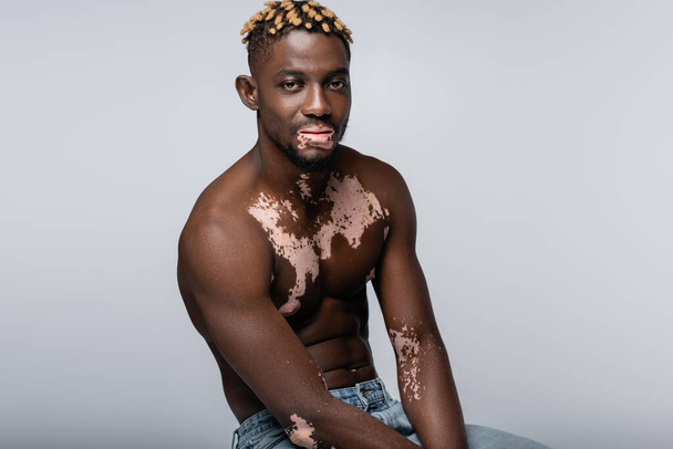 shirtless and muscular african american man with vitiligo skin looking at camera isolated on grey - Foto, Bild