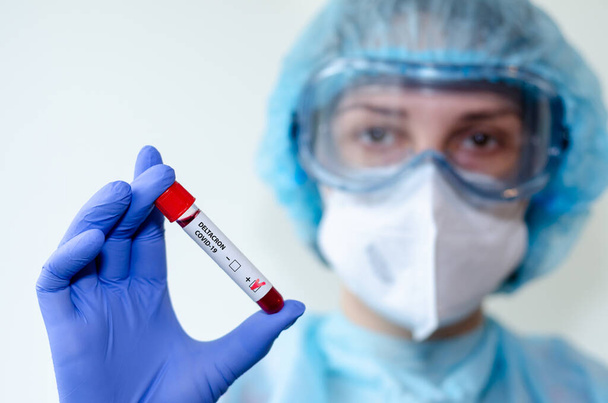 Medical laboratory assistant holding test tube with positive Deltacron COVID-19 test blood sample. - Foto, Imagem