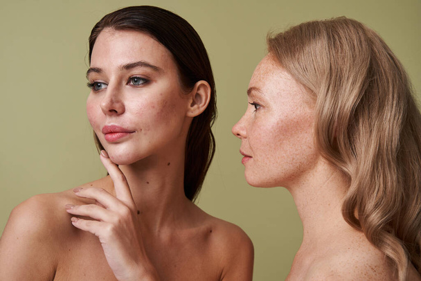 Brunette woman with skin imperfections looking away while freckled girl standing - Photo, image