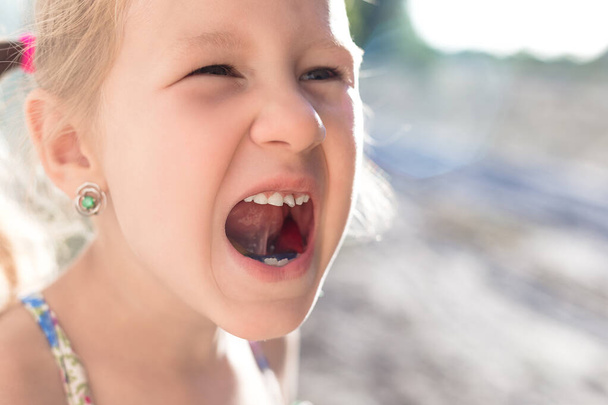 Мила маленька дитина відкрила рот і показала колисковий дитячий зуб
 - Фото, зображення