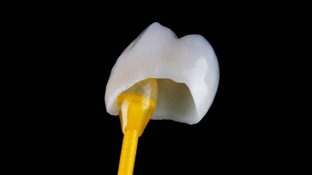 corona dentale su uno speciale bastone dentale per il fissaggio su un dente vivo - Foto, immagini