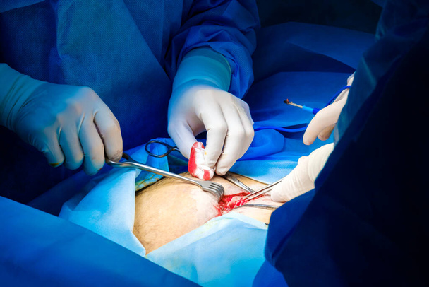Two pairs of hands of surgeons in xing operate on a person. - Foto, Imagen