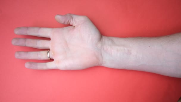 Eine Narbe am Handgelenk nach einer Sehnen- und Nervenoperation, ein Schnitt an der Hand, eingeschränkte Bewegung am Daumen. Erholung, Sehnenentwicklung. Männerhände auf rotem Hintergrund - Filmmaterial, Video