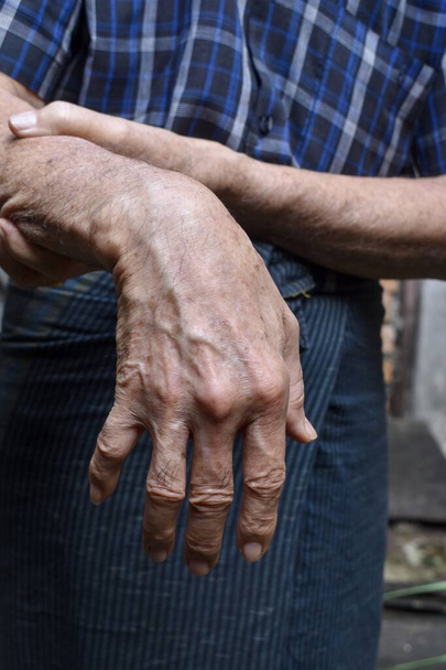 Radicale zenuwbeschadiging of polsdruppel van Aziatische oudere man. - Foto, afbeelding