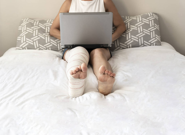 a young woman sitting on the bed with the laptop with the leg in bandage - Foto, Imagem