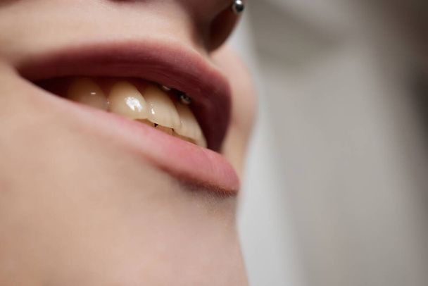 smile or frenulum piercing under the upper lip. - Foto, Imagen
