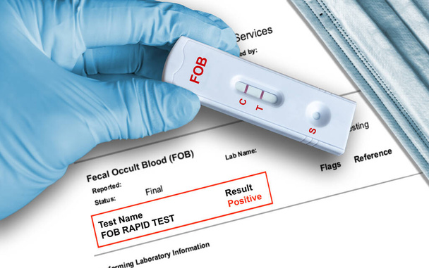 Fecal Occult Blood (FOB) позитивний результат тестування за допомогою пристрою швидкого тестування, який тримається вручну в медичній рукавичці з медичною маскою для обличчя на задньому плані. Тест FOB виявляє проблеми шлунково-кишкового тракту, такі як рак товстої кишки, виразки, поліпи, коліт, дивертикуліт
 - Фото, зображення