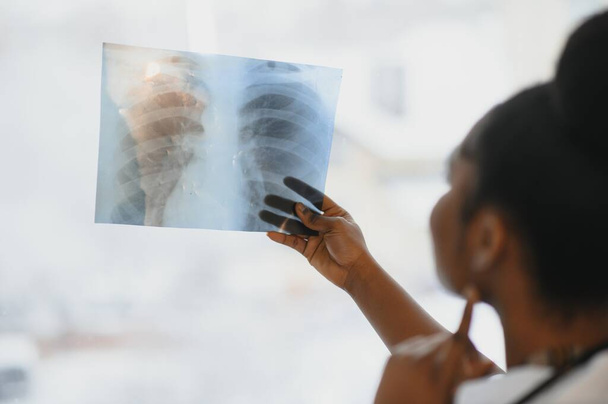 Young professional African-American doctor examining x-ray of patients chest - Φωτογραφία, εικόνα