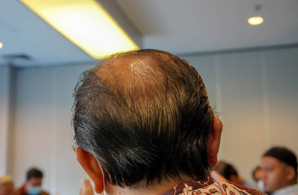 Reifer Mann, von hinten gesehen, im Kopf, beginnt Haare zu verlieren, er beginnt alt zu werden. - Foto, Bild