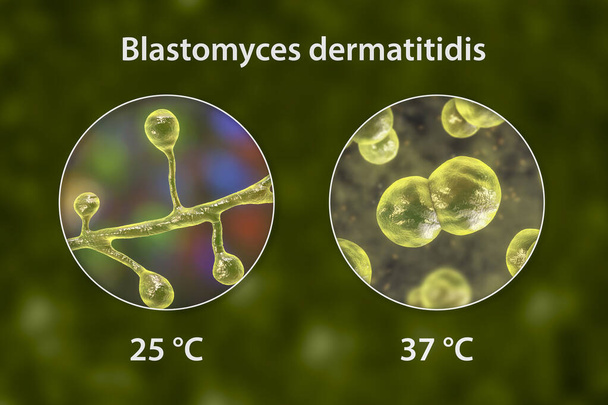 Blastomyces dermatitidis fungi, the causative agent of blastomycosis in lungs and other organs, 3D illustration. Dimorphic fungi producing filamentous (at 25 degrees)and yeast (at 37 degrees) forms - Photo, Image