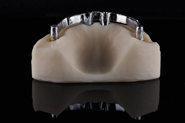 титановый луч с красивым шлифованием на специальной модели для имплантации нижней челюсти - Фото, изображение