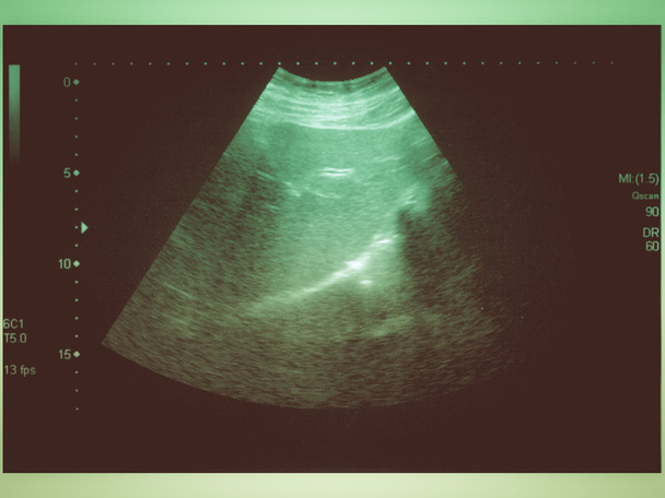 Retro look Ultrasound scan - Photo, Image