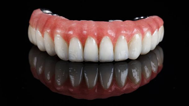 hermosa composición de la prótesis con una goma rosa de la mandíbula inferior en vidrio negro con reflexión - Foto, imagen