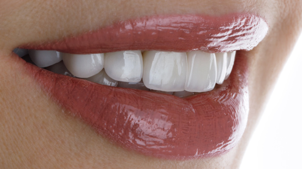 sourire parfait d'une fille avec placages et beau rouge à lèvres - Photo, image