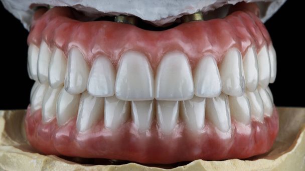 high-quality dental prosthesis of the lower and upper jaws on the dental model in the bite - Photo, Image