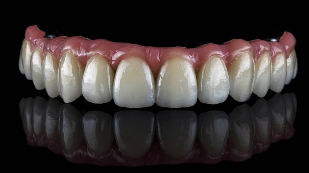 Seramiklerden yapılmış diş protezi ve siyah arkaplanda üst çene için pembe sakız  - Fotoğraf, Görsel