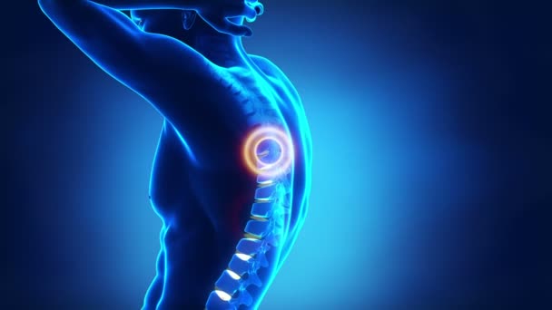 Backbone pain problem - Footage, Video
