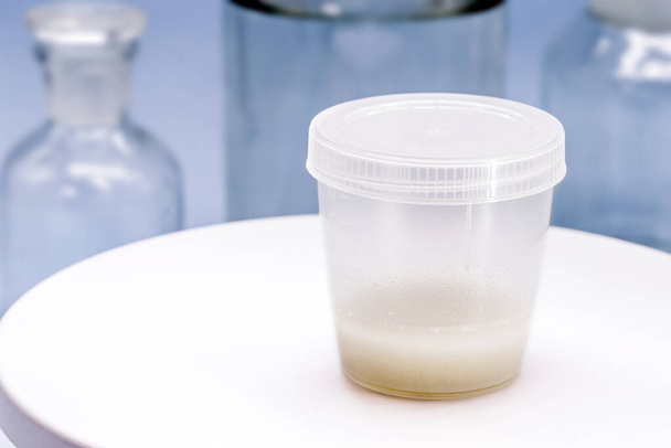 recipiente de colheita de amostras, com sémen destinado a cultura de esperma, para detectar a presença de agentes patogénicos - Foto, Imagem