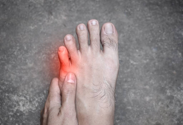 Pequeno dedo do pé doloroso do jovem asiático. Causado por teimoso dedo do pé, dedo do pé quebrado, unha encravada, joanetes, calos ou sapatos mal ajustados. - Foto, Imagem