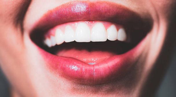 Smile teeth. Laughing woman mouth with great teeth close up. Healthy white teeth. Closeup of smile with white healthy teeth. - Photo, Image