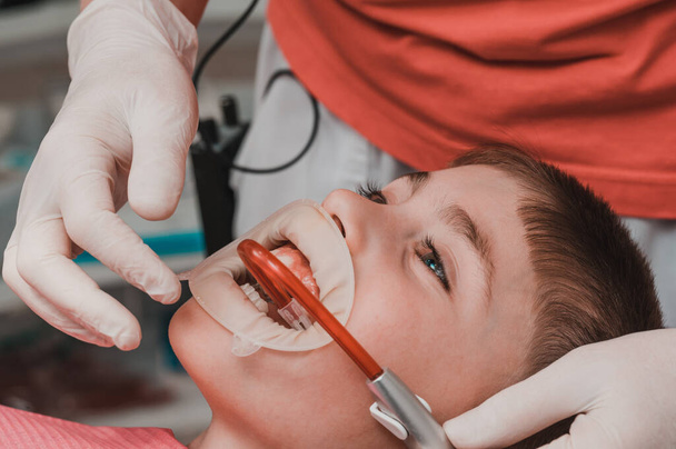 Ребенок сидит в стоматологическом кресле, выбрасыватель слюны во рту, кариес у ребенка, руки стоматолога в перчатках, зубной расширитель на губах мальчика. - Фото, изображение
