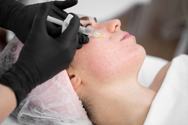 Close-up of cosmetologist makes the Rejuvenating facial injections procedure for tightening on the face skin of woman in a beauty clinic. Biorevitalization procedure - Foto, afbeelding