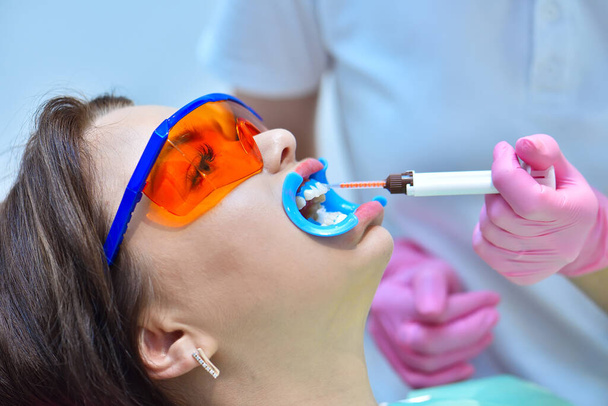 Dentist in pink gloves applies whitening gel to patient's teeth in dental clinic. Teeth whitening in a dental clinic concept. Close up - Foto, Bild
