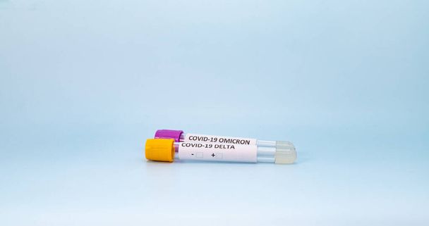 dvě vakuové zkumavky pro odběr a krevní vzorky s natrium-citrátem do laboratoře. Na modrém pozadí, pro kovid diagnostiku - Fotografie, Obrázek