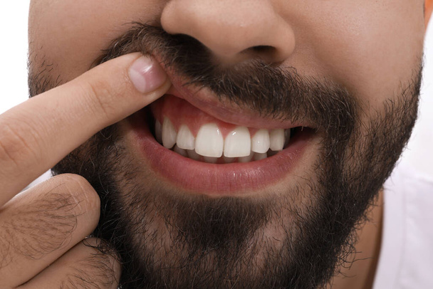 Young man showing white teeth, closeup view - 写真・画像