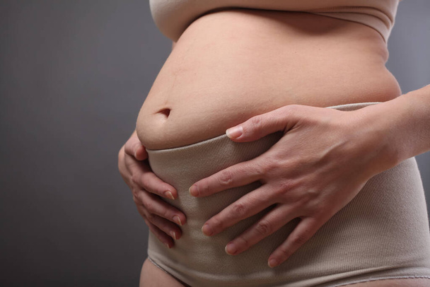 exceso de peso en el vientre en las manos de una mujer joven después de dar a luz - Foto, Imagen