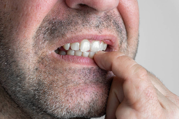 Hombre caucásico, primer plano de dientes mordiendo uñas - Foto, imagen