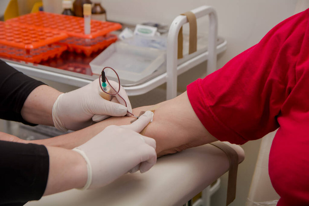 Ο γιατρός αντλεί αίμα από φλέβα του ασθενούς χρησιμοποιώντας ένα σύστημα ανάλυσης. - Φωτογραφία, εικόνα