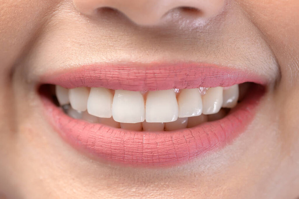 Zblízka bílé zdravé zuby krásného úsměvu mladá žena - Fotografie, Obrázek