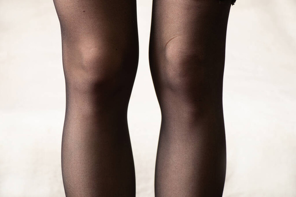 female legs in black stockings on a white background, female knees close-up - Φωτογραφία, εικόνα