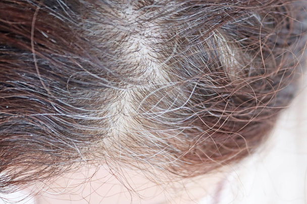 Se on osa naisen päätä. Naisen pää ja osittain harmaat hiukset - Valokuva, kuva
