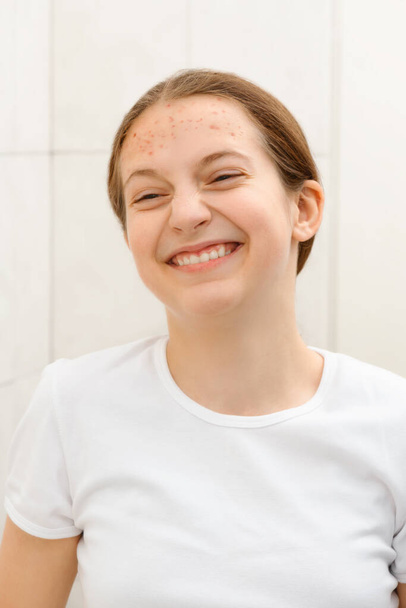 Gesicht eines Teenager-Mädchens mit Pickeln, sie sieht sich selbst im Spiegel an, grimmig und lustig, Akne auf der Haut, Konzept von Schönheit und Gesundheit - Foto, Bild