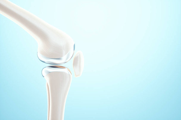 Medical poster image of the bones of the knee, the joint in the knee. Arthritis, inflammation, fracture, cartilage,. Copy space, 3D illustration, 3D render - Photo, Image