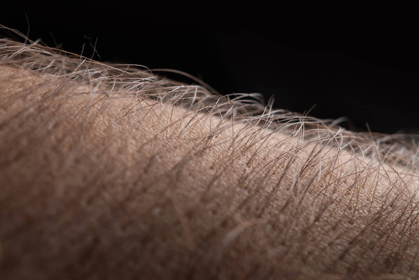 Human skin with hair on black background. Goose bumps. - Photo, Image