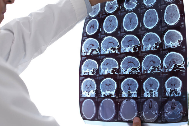 Doctor examining MRI images of patient with multiple sclerosis in clinic, closeup - Foto, Imagen