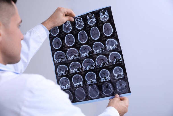 Doctor examining MRI images of patient with multiple sclerosis in clinic, closeup - Фото, изображение