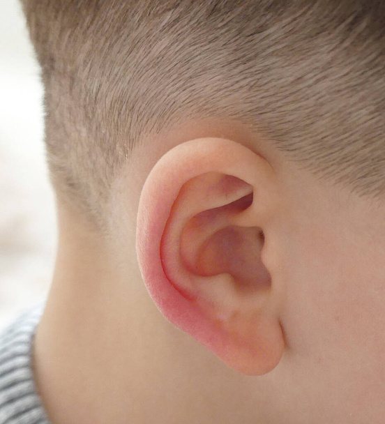 otite média em crianças, uma criança ocupa seu ouvido, criança com dor de ouvido sofre, inflamação do ouvido, - Foto, Imagem