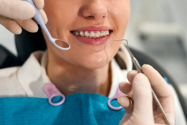 Sneeuwwitte glimlach van een vrouwelijke patiënt met beugels op onderzoek door een tandarts in een tandheelkundige kliniek met moderne apparatuur. Tandheelkundige verzorging en tandheelkunde. - Foto, afbeelding
