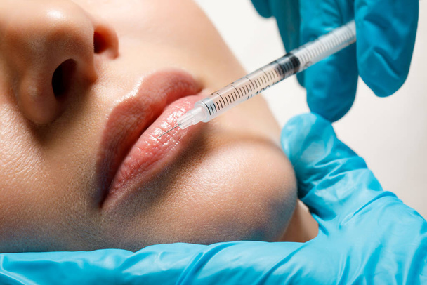 Lip augmentation and correction procedure in a cosmetology salon. The specialist makes an injection in the patient lips. - Photo, Image