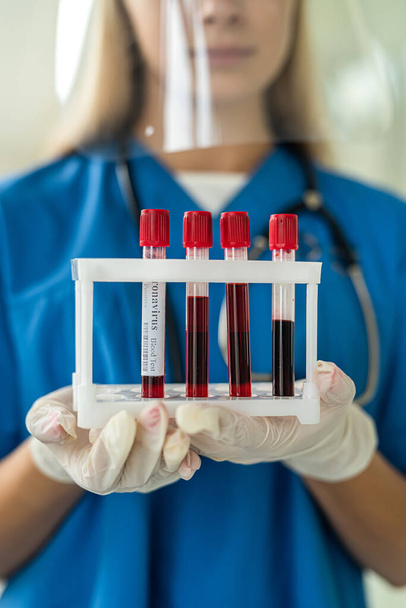uma jovem enfermeira de uniforme transporta tubos de ensaio com amostras de sangue para o laboratório. Conceito de medicina - Foto, Imagem