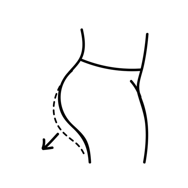 Women beauty face plastic surgery. Buttock augmentation. Body contouring. Hand drawn vector illustration. Editable line stroke - Vector, Image