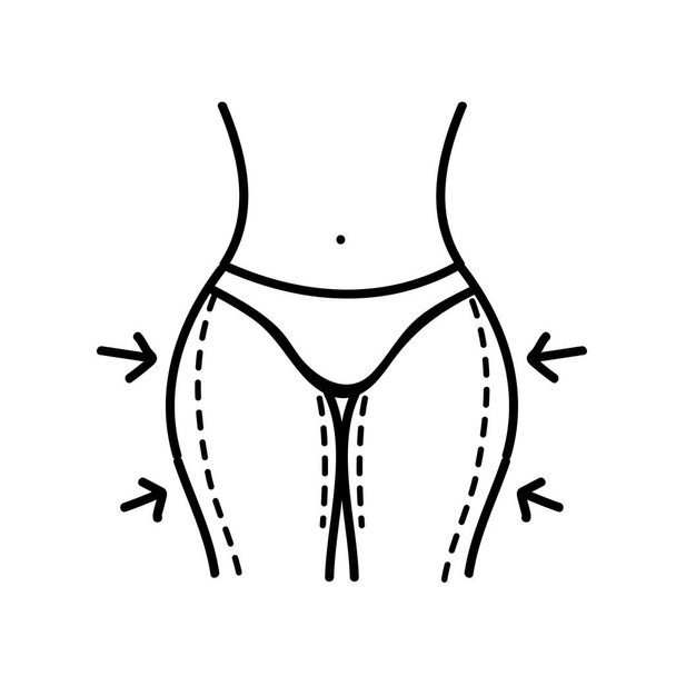 Naiset kohtaavat kauneusleikkauksen. Reisirasva rasvaimu. Kehon ääriviivat. Käsin piirretty vektorikuva. Muokattava viiva aivohalvaus - Vektori, kuva