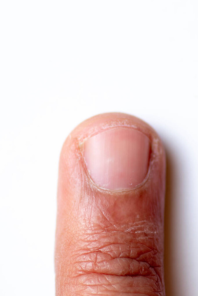 Dedos, manos y uñas. Partes masculinas del cuerpo humano de 20 a 30 años - Foto, imagen
