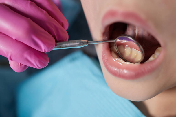 lähikuva nuoresta tytöstä hammaslääkärissä ja hammaspeilin avulla nähdä vauvan hampaat ja ikenet. - Valokuva, kuva