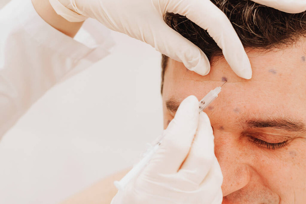 Cosmetoloog voert verjonging procedure zet Botox injectie op de mens. Het concept verjongende behandelingen - Foto, afbeelding